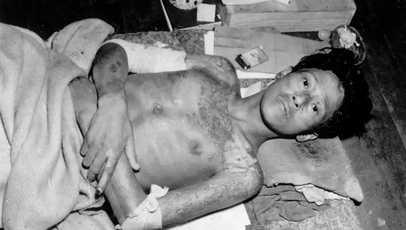 80 Yıl Sonra Nagasaki'den Gelen Uyarı: Nükleer Tehdit Artıyor